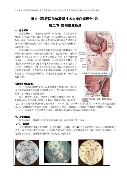 前列腺液-终极资料整理