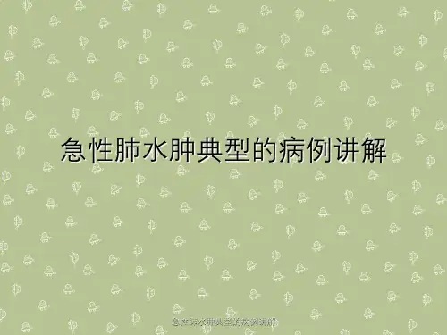 急性肺水肿典型病例讲解