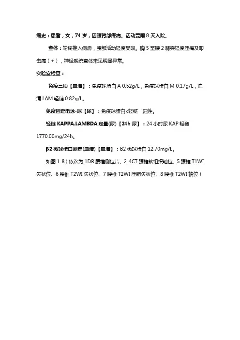 胸腰椎多发结节状异常信号--多发骨髓瘤