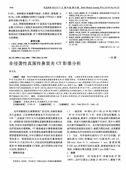 非侵袭性真菌性鼻窦炎 CT 影像分析