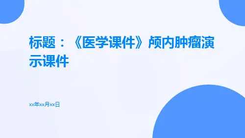 (医学课件)颅内肿瘤演示课件