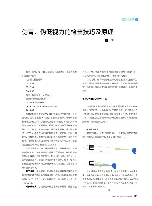 伪盲、伪低视力的检查技巧及原理