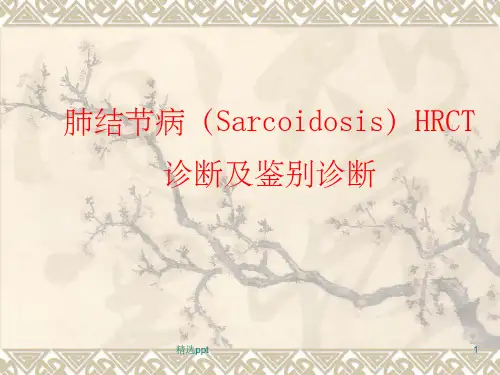 结节病HRCT诊断及鉴别诊断ppt课件