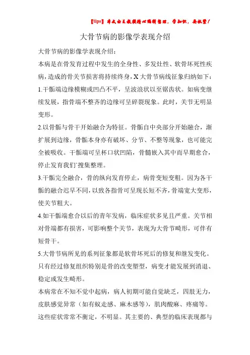 大骨节病的影像学表现介绍