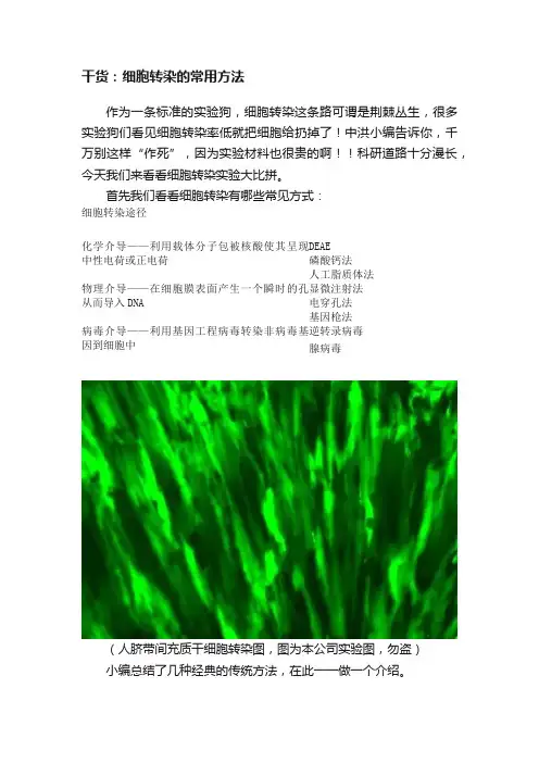 干货：细胞转染的常用方法