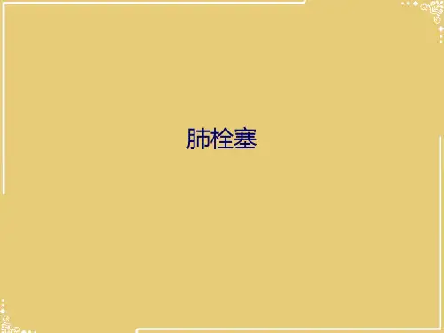 肺栓塞【共45张PPT】