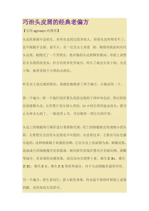 巧治头皮屑的经典老偏方