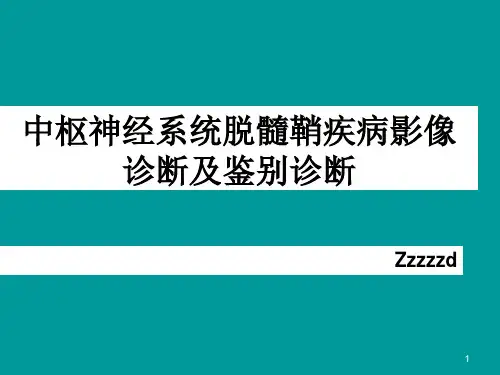 脱髓鞘疾病影像表现
