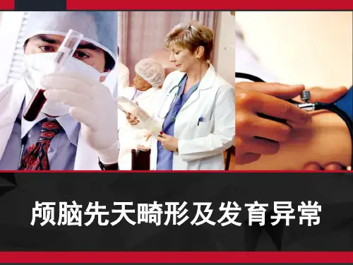 颅脑先天畸形及发育异常 PPT