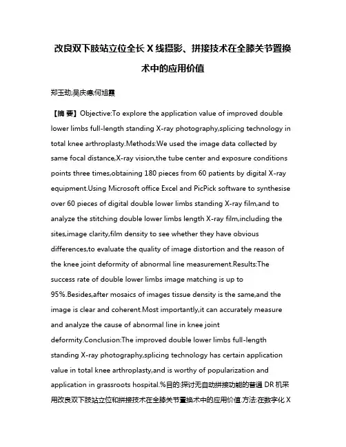 改良双下肢站立位全长X线摄影、拼接技术在全膝关节置换术中的应用价值