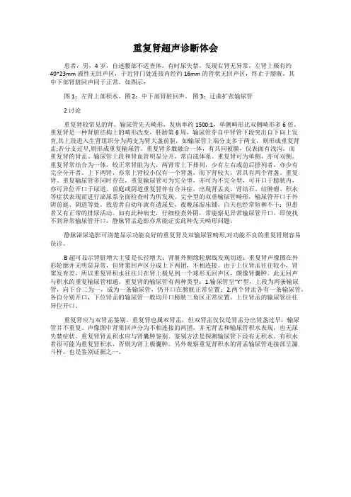 重复肾超声诊断体会