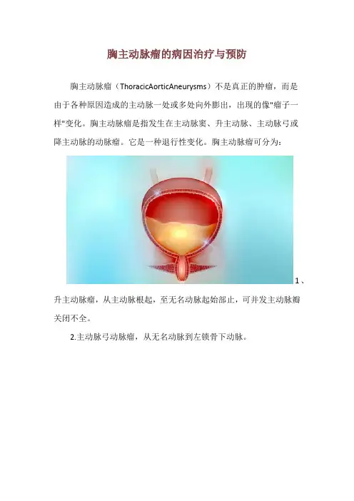 胸主动脉瘤的病因治疗与预防