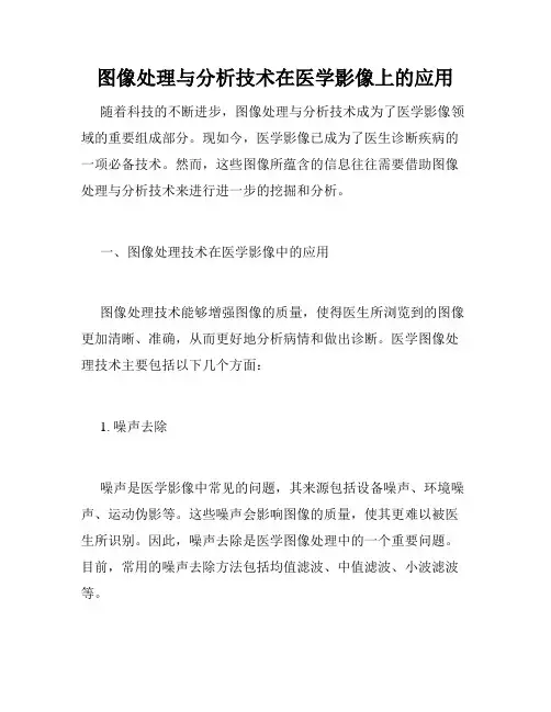 图像处理与分析技术在医学影像上的应用