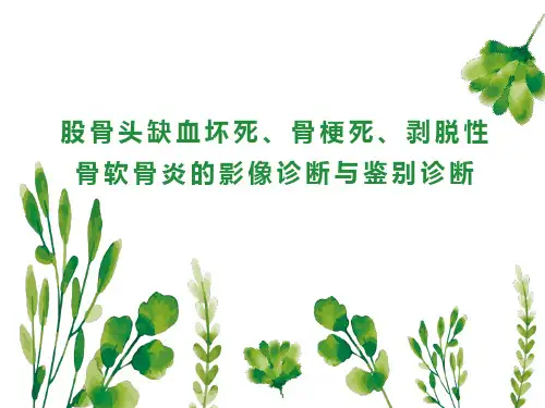 股骨头缺血坏死、骨梗死、剥脱性骨软骨炎的影像诊断与鉴别诊断