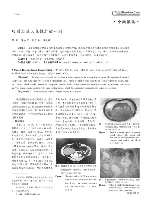 腹膜后巨大良性肿瘤一例