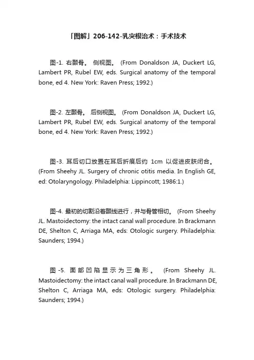 「图解」206-142-乳突根治术：手术技术