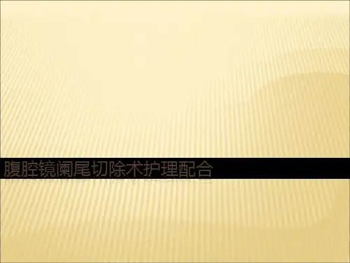 腹腔镜阑尾切除术护士配合