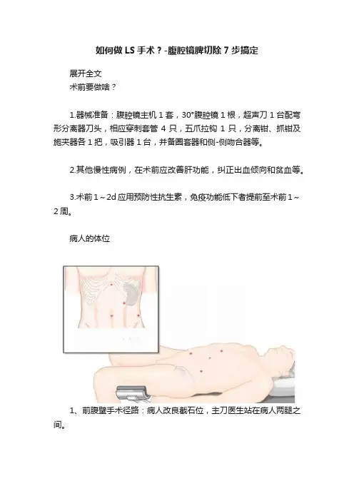 如何做LS手术？-腹腔镜脾切除7步搞定