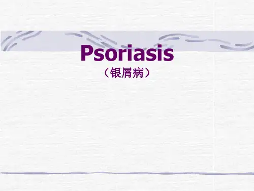 皮肤性病学英文课件：08  Psoriasis