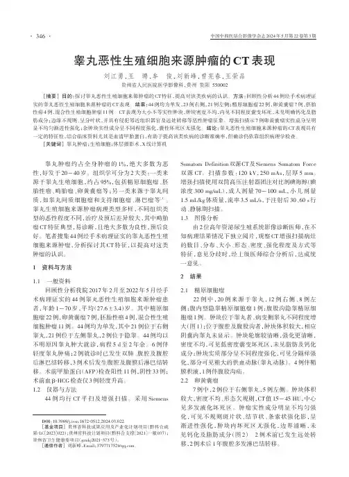睾丸恶性生殖细胞来源肿瘤的CT表现