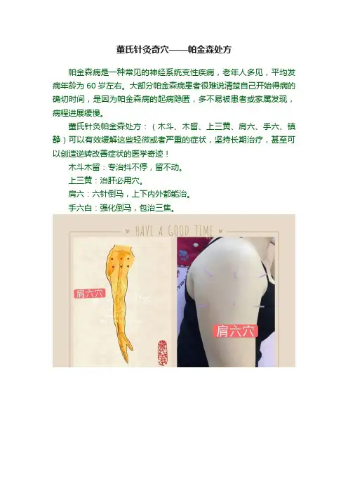 董氏针灸奇穴——帕金森处方