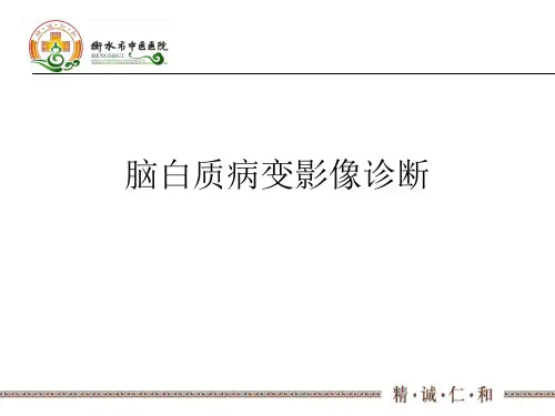 脑白质病变影像诊断 (2)