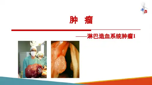 常见肿瘤—淋巴造血系统肿瘤(病理学课件)
