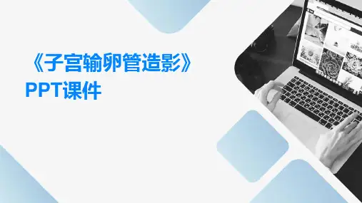 《子宫输卵管造影》课件
