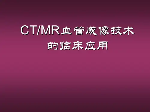 CTMR血管成像技术的临床应用 (精品)