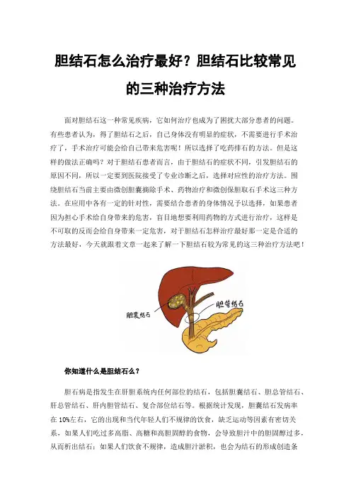 胆结石怎么治疗最好？胆结石比较常见的三种治疗方法