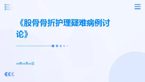 股骨骨折护理疑难病例讨论