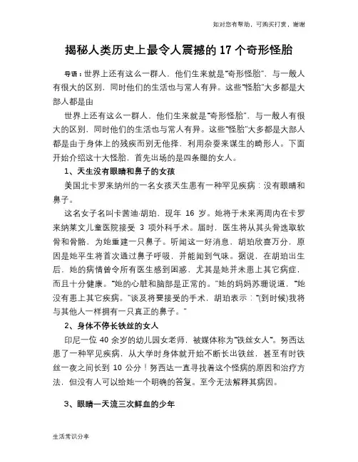 揭秘人类历史上最令人震撼的17个奇形怪胎
