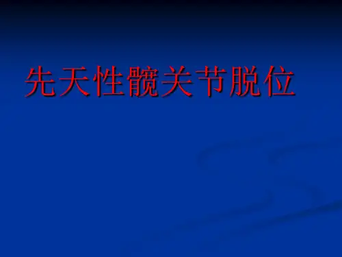 下肢畸形