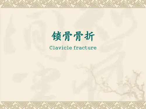 锁骨骨折PPT课件