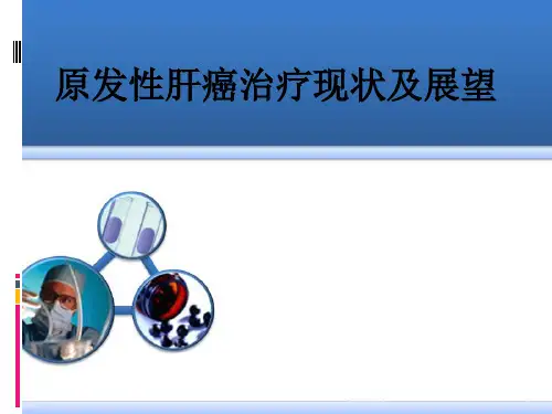 肝癌的治疗PPT课件