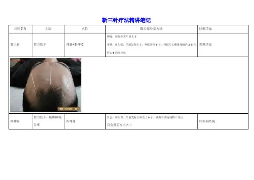 靳三针疗法精讲笔记附图