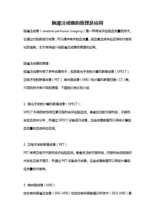 脑灌注成像的原理及应用
