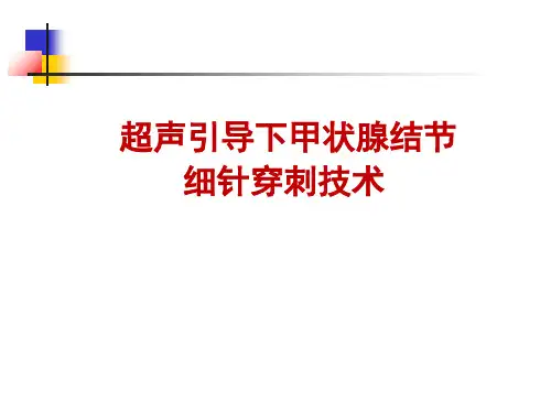 甲状腺结节细针穿刺 PPT资料共48页