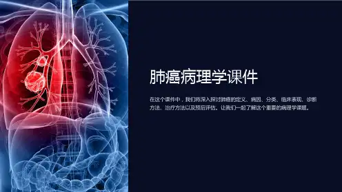 《肺癌病理学课件》