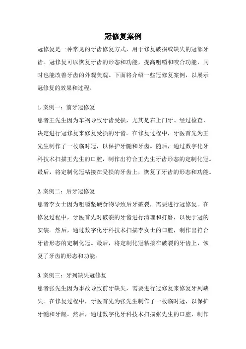 冠修复案例