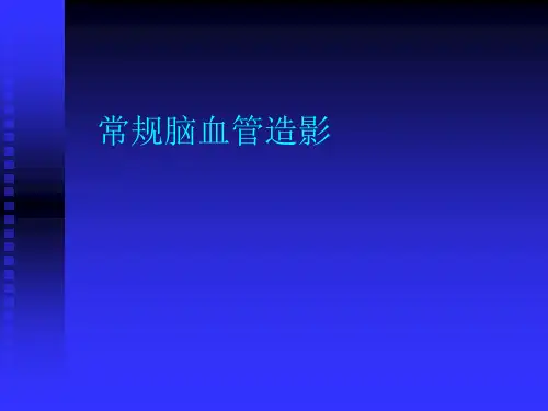 常规脑血管造影
