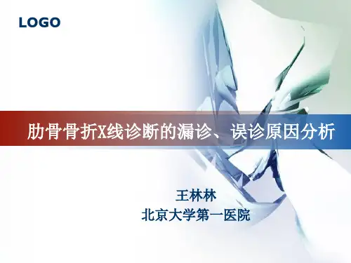 肋骨骨折的影像学表现