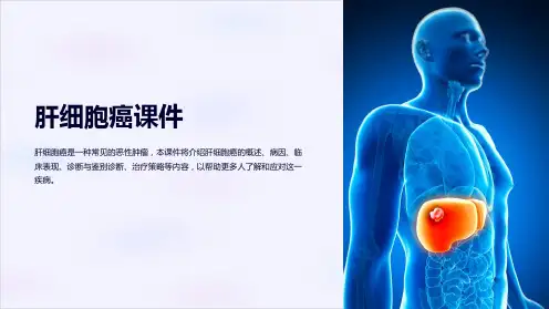 《肝细胞癌课件》