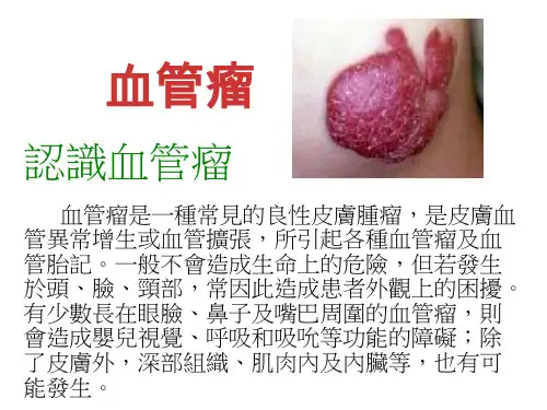 血管瘤-PPT课件