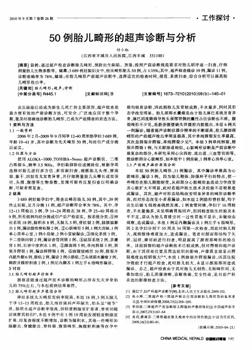 50例胎儿畸形的超声诊断与分析