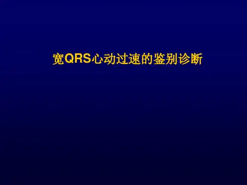宽qrs心动过速的鉴别诊断