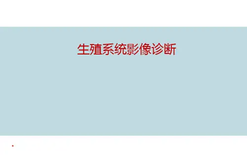 【医学课件】生殖系统影像诊断