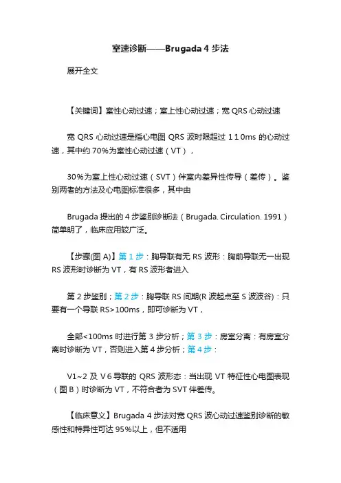 室速诊断——Brugada?4步法