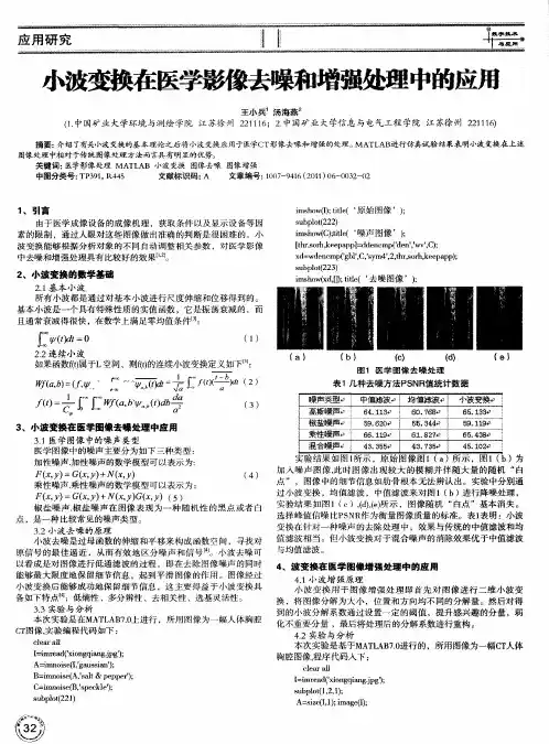 小波变换在医学影像去噪和增强处理中的应用