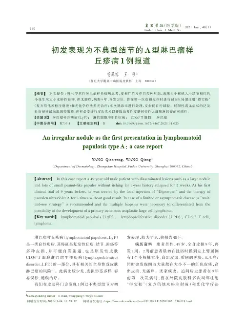 初发表现为不典型结节的A型淋巴瘤样丘疹病1例报道